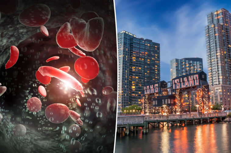 long-island-has-a-‘high-burden’-for-a-common-blood-disorder:-new-study