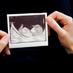being-pro-life-can-turn-the-cruelest-circumstances-into-hope-and-love