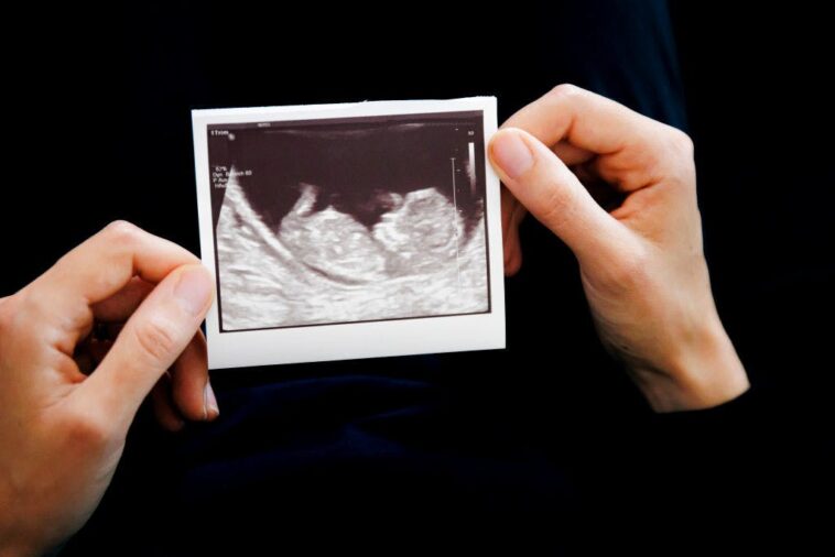 supreme-court-takes-unusual-step-as-legal-showdown-intensifies-over-mail-in-abortion-drug
