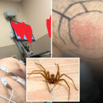 kyle-rittenhouse-suffers-nasty-brown-recluse-bite,-compares-spider-to-‘communists’:-‘couldn’t-take-me-out’