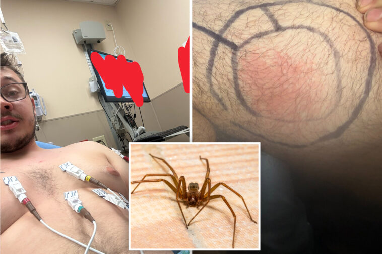 kyle-rittenhouse-suffers-nasty-brown-recluse-bite,-compares-spider-to-‘communists’:-‘couldn’t-take-me-out’