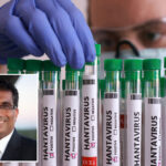 key-reason-why-hantavirus-won’t-turn-into-a-covid-pandemic,-according-to-leading-health-expert
