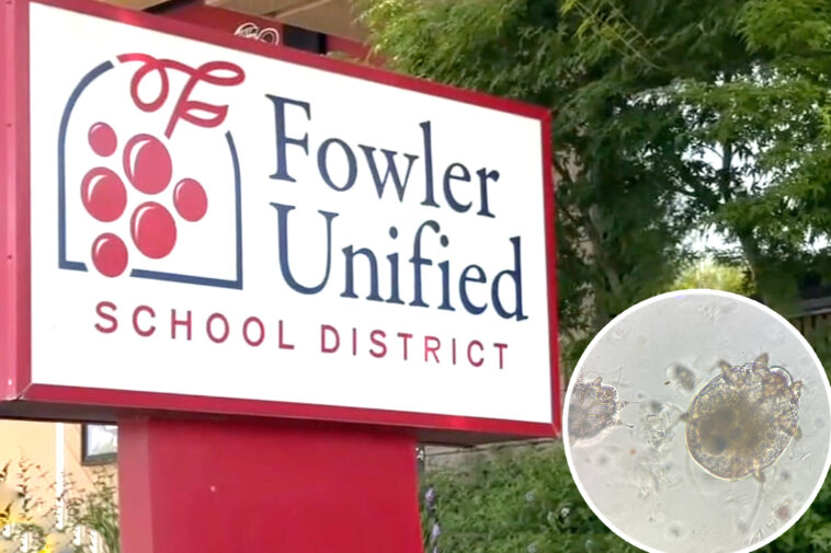 outbreak-of-horrific-skin-eating-disease-at-california-school