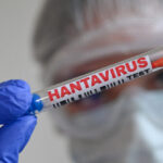 cruise-hantavirus-infections-total-11,-who.-says-cases-will-rise,-but-outbreak-under-control