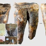 tooth-shows-cavemen-conducted-dental-surgery-thousands-of-years-before-anesthetic