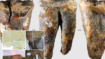 tooth-shows-cavemen-conducted-dental-surgery-thousands-of-years-before-anesthetic