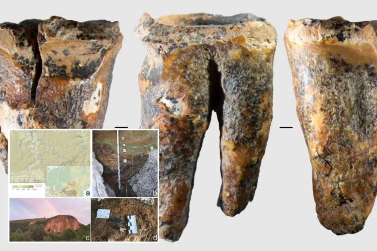 tooth-shows-cavemen-conducted-dental-surgery-thousands-of-years-before-anesthetic