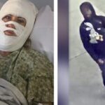 georgia-acid-attack-victim-lashes-out-at-savannah-mayor-and-police-for-withholding-video-evidence,-suggesting-she-personally-knew-suspect
