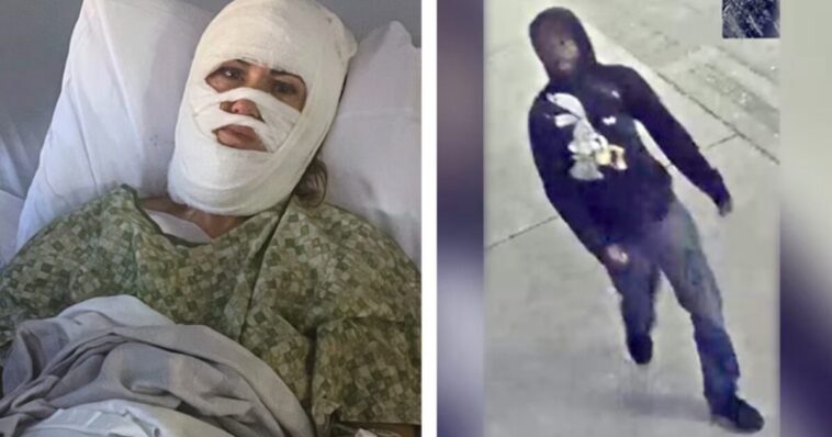 georgia-acid-attack-victim-lashes-out-at-savannah-mayor-and-police-for-withholding-video-evidence,-suggesting-she-personally-knew-suspect