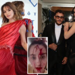 blood-covered-beauty-queen-releases-video-of-shocking-aftermath-following-attack-by-celebrity-stylist