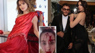 blood-covered-beauty-queen-releases-video-of-shocking-aftermath-following-attack-by-celebrity-stylist