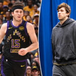 lakers-dodgers-connection-paid-off-with-austin-reaves’-oblique-injury-rehab