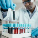 the-‘age’-of-your-blood-could-predict-dementia-risk,-new-study-suggests