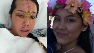 tourist’s-trip-turns-into-a-nightmare-after-simple-act-of-kindness-leaves-her-in-the-icu