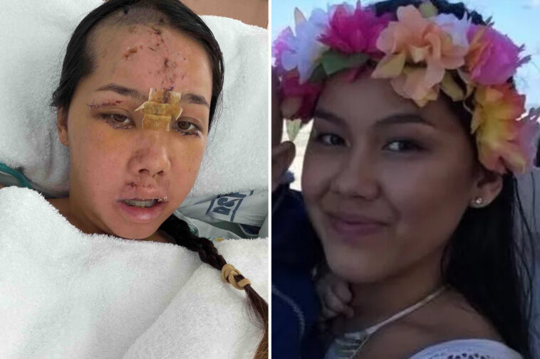 tourist’s-trip-turns-into-a-nightmare-after-simple-act-of-kindness-leaves-her-in-the-icu