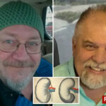 organ-donor-unwittingly-had-rabies-—-and-now-one-kidney-recipient-is-dead-and-others-are-at-risk