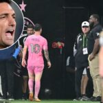 how-argentina-is-handling-a-possible-lionel-messi-world-cup-injury