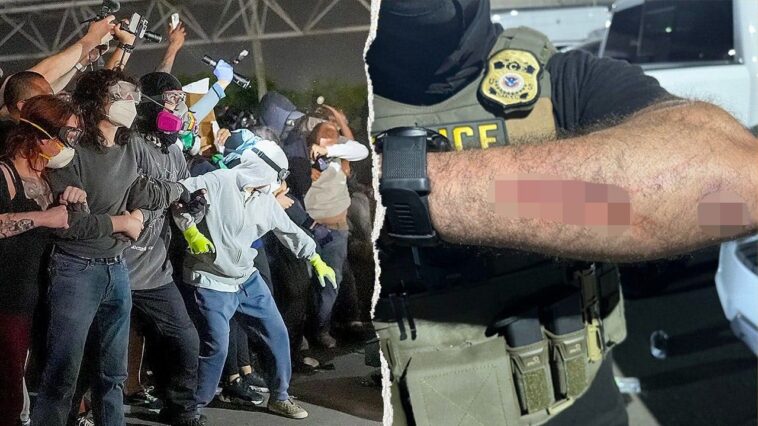 man-charged-with-assaulting-federal-officers-after-allegedly-biting-ice-agents-at-newark-anti-ice-protest