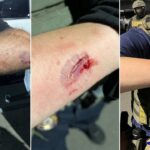 anti-ice-agitator-charged-with-allegedly-biting-officers-during-delaney-hall-clashes