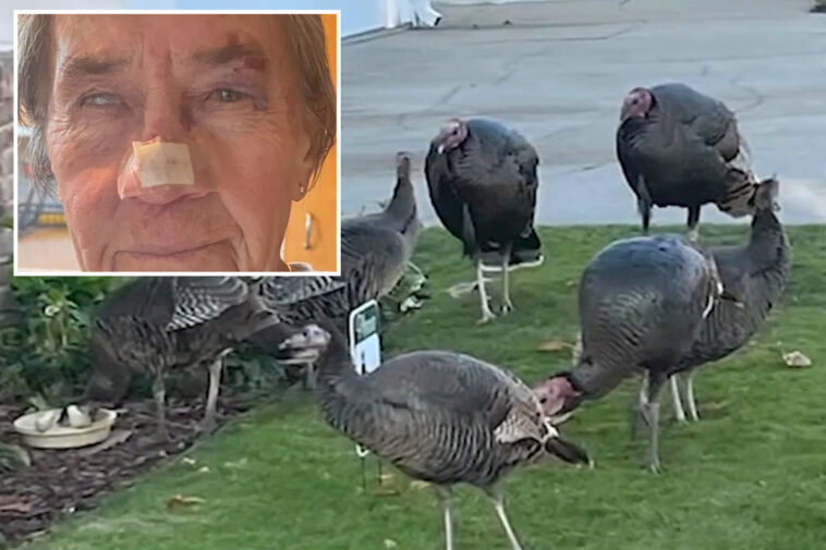 california-woman,-83,-left-with-horrific-injuries-after-being-attacked-by-gang-of-wild-turkeys