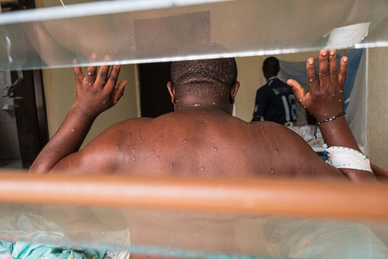 leftist-scientists-caught-sneaking-113-vials-of-monkeypox-into-america