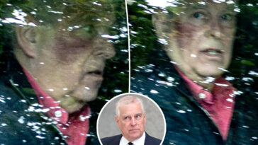 disgraced-ex-prince-andrew-seen-with-giant,-mysterious-bruise-on-face