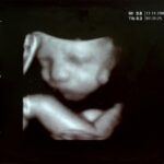 they-didn’t-get-the-perfect-baby-so-at-5-months-they-murdered-it