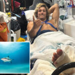 surfer-escapes-death-in-jaws-of-aussie-shark-—-and-says-he-used-a-simple-trick-to-survive