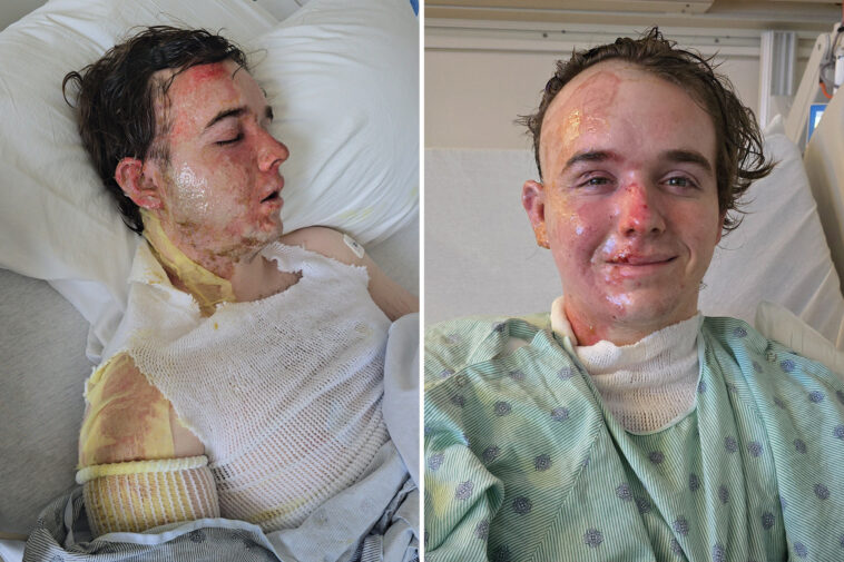 mcdonald’s-employee-in-icu-after-coworker-allegedly-threw-hot-oil-on-him:-‘why-would-he-do-this-to-me?’