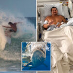 surfer-describes-how-8-foot-shark-ripped-open-his-legs:-‘my-calf-is-pretty-much-wide-open’