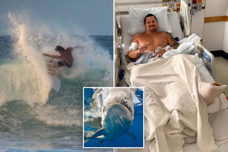 surfer-describes-how-8-foot-shark-ripped-open-his-legs:-‘my-calf-is-pretty-much-wide-open’