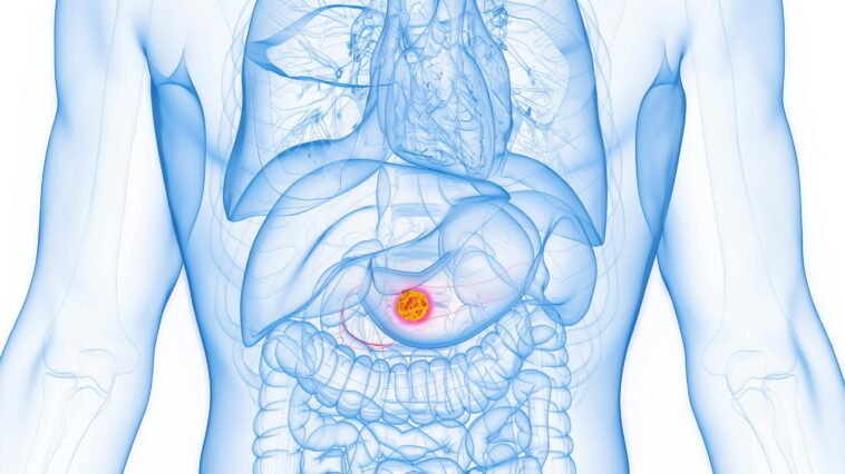 popular-‘healthy’-fat-found-to-fuel-deadly-pancreatic-cancer
