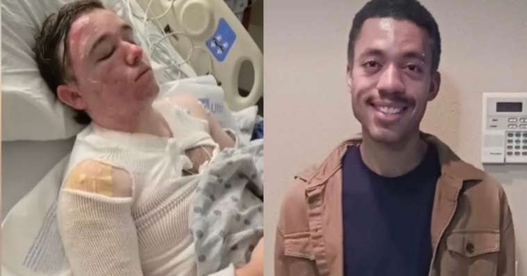 horror!-20-year-old-mcdonalds-manager-hospitalized-with-third-degree-burns-after-employee-threw-hot-oil-on-him-–-“why-would-he-do-this-to-me?”-(video)