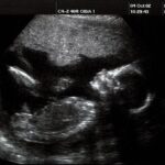 america’s-fertility-crisis-has-astonishing-new-link-to-iphones,-study-finds