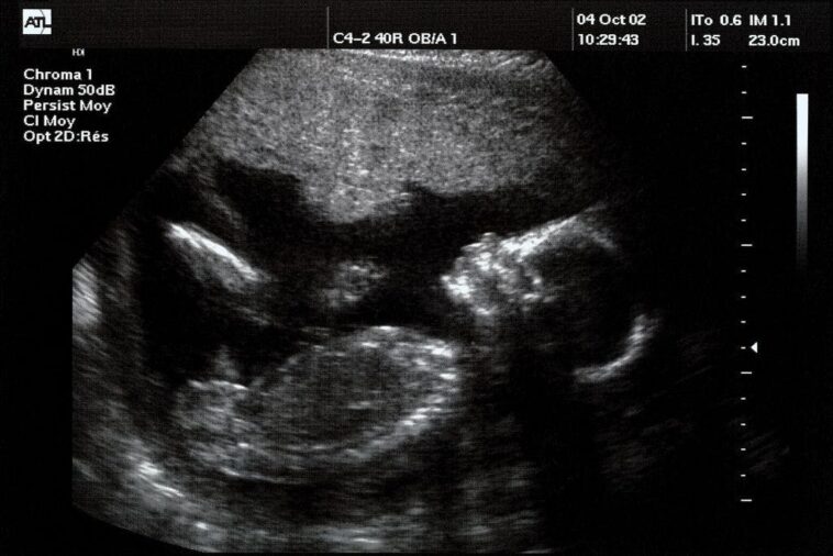 america’s-fertility-crisis-has-astonishing-new-link-to-iphones,-study-finds