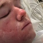 mcdonald’s-worker-says-he’s-fighting-severe-burns-after-hot-oil-attack
