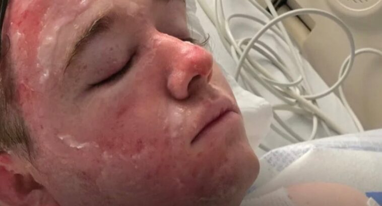 mcdonald’s-worker-says-he’s-fighting-severe-burns-after-hot-oil-attack