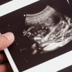 he-thought-he-was-defending-abortion-instead,-he-exposed-it.