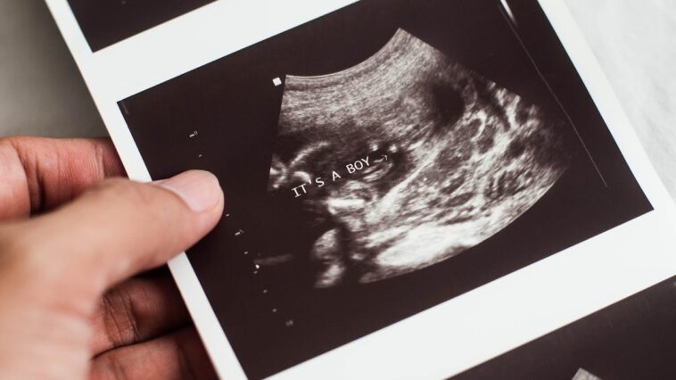 he-thought-he-was-defending-abortion-instead,-he-exposed-it.