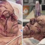 northern-ireland:-belfast-victim-remains-in-serious-condition-with-horrific-facial-wounds-as-details-emerge-about-deranged-sudanese-attacker