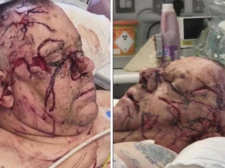 northern-ireland:-belfast-victim-remains-in-serious-condition-with-horrific-facial-wounds-as-details-emerge-about-deranged-sudanese-attacker