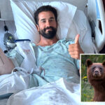 fresh-hell-for-california-baseball-star-daniel-crago-after-his-arm-was-ripped-apart-by-grizzly-bear-in-montana