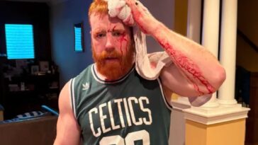 wwe-star-sheamus-shows-off-gruesome-head-injury-in-bloody-‘gym-fail’