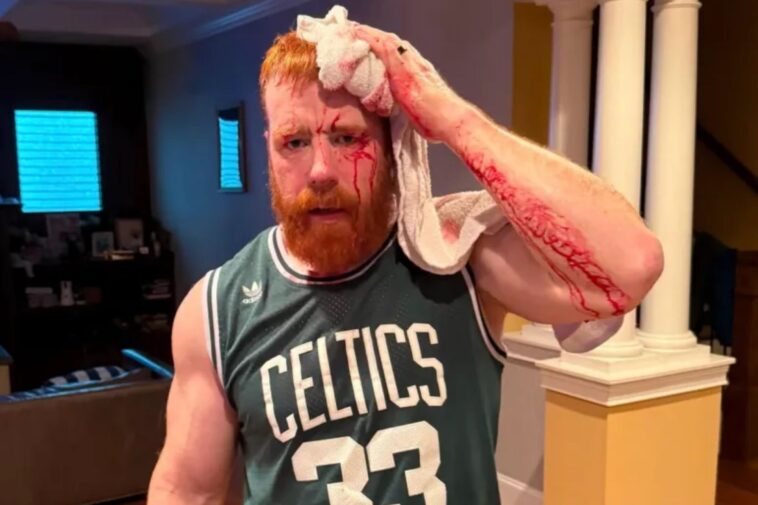 wwe-star-sheamus-shows-off-gruesome-head-injury-in-bloody-‘gym-fail’