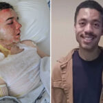 california-mcdonald’s-boss-breaks-silence-after-coworker-scalded-him-with-boiling-hot-oil:-‘one-of-the-hardest-things-of-my-life’