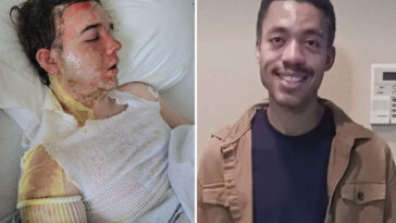 california-mcdonald’s-boss-breaks-silence-after-coworker-scalded-him-with-boiling-hot-oil:-‘one-of-the-hardest-things-of-my-life’