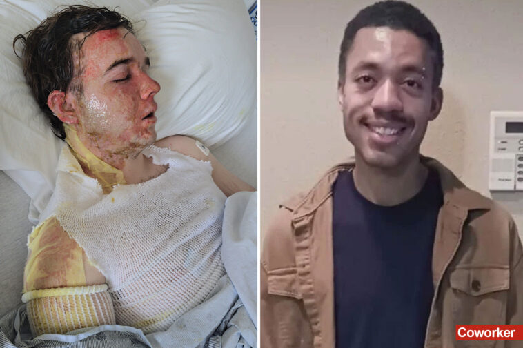 california-mcdonald’s-boss-breaks-silence-after-coworker-scalded-him-with-boiling-hot-oil:-‘one-of-the-hardest-things-of-my-life’