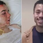 young-mcdonald’s-worker-in-icu-after-co-worker-doused-him-in-boiling-oil,-according-to-horrified-mom
