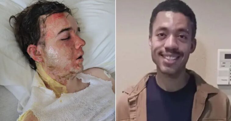 young-mcdonald’s-worker-in-icu-after-co-worker-doused-him-in-boiling-oil,-according-to-horrified-mom