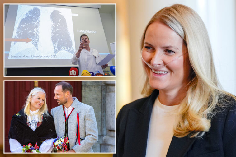 norway’s-crown-princess-undergoes-successful-lung-transplant,-palace-says